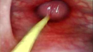 EXTREME ANAL POV. CAMERA INSIDE HER ASSHOLE AS I POUND HER WITH MY BIG COCK AND CUM DEEP INSIDE