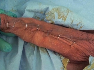 Penis Stapling for slave Renne Part1